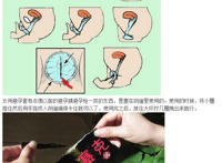 女用避孕套演示大图图解：女用避孕套演示过程