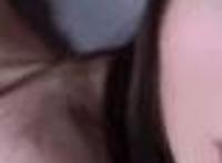 女性阴囊毛囊炎图片 啤酒加味精给女人喝