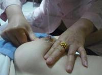 奶涨的疼有什么办法  奶涨太频繁有什么办法