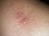 做完爱老公龟头有红点 和老公做完还是想