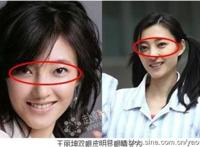 王丽坤整容前后照片