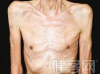 肺癌晚期死前症状