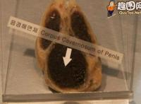 男性器官解剖图