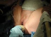 妇女自然分娩全过程图