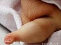 男性包茎手术多少钱