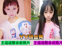 王逗逗整容前后图