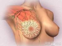 乳房溢乳怎么治