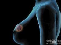 乳头溢液是什么原因