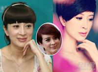 金巧巧整容前后照片