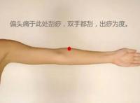 偏头痛解决小技巧