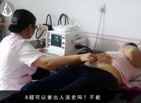 小常识:B超可以查出女孩做过人流吗