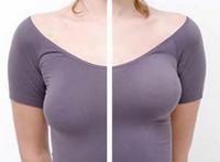 长时间穿高跟鞋会让你的乳房下垂