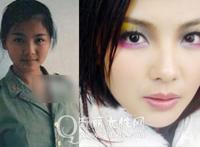 刘涛整容前后照片