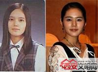 秋瓷炫整容前后对比照片