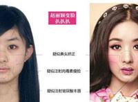 赵丽颖整容前后照片