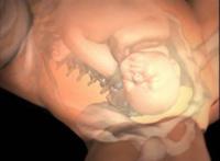 顺产侧切伤口图片:顺产视频全过程 顺产侧切伤口图片:顺产视频全过程