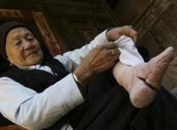 古代女人裹脚图片：以前古代人的裹脚 图片