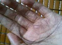 女性掉发原因及治疗，女性脱发吃什么长头发 总是掉头发吃什么好