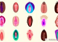 从阴道看生育力 私处毛发疯长可能不孕