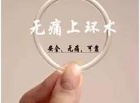 女性戴环好吗？少女能节育环吗