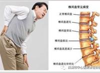 腰椎间盘突出腿疼厉害怎么办