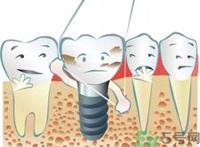 牙线会使牙缝变大吗?牙线会让牙缝变大吗?