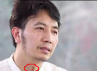 采访林生斌脖子有吻痕