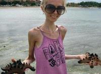 世界上最瘦的女人是谁 kseniya bubenko皮包骨头的图片