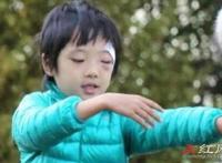 费曼眼睛怎么伤的 打闹的时候被推到磕在了桌角上