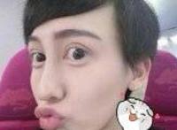 刘梓晨以前长啥样 融掉玻尿酸之后是什么样子呢