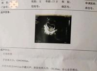 医生说怀男孩的特点 三个特征有一个就是重男轻女