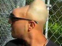半脑哥活了多久 半个脑袋为什么可以存活
