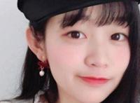 刁卓胡先煦什么关系 刁卓整容前后对比照片网上流传让人震惊