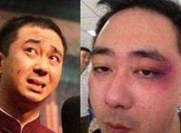 王自健被老婆打是真的吗 王自健遭老婆薛继红家暴让人震惊