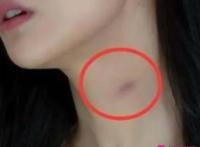 男人喜欢在脖子上种草莓的原因