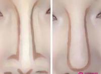 男生塌鼻子一定丑吗
