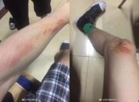情侣校园搂抱被殴，起因是不是本校学生不配合登记