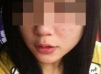 女孩卧室直播割腕，因失恋做出的傻事