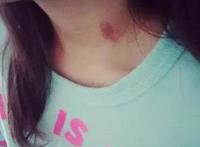 给男朋友种草莓的技巧，草莓印怎么吻出来的?