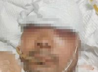 惨剧！银川一男子给轮胎充气发生爆炸，头部血肉模糊左眼爆裂