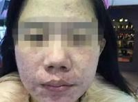 从女神到女骗子，背后是有毒的朋友圈