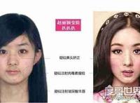 赵丽颖整容前后照片对比，整张脸完全不同了