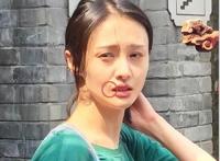 郑爽嘴角伤疤原因，因拍摄电视剧不小心被烫伤(并不是整容失败)