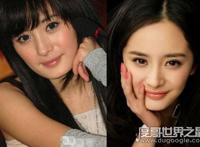 杨幂整容前后照片对比，整容失败留下后遗症曝光