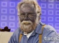 全球十大恐怖怪病，让人心生恐惧（怪病）