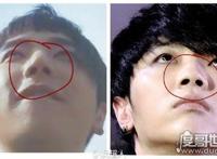 华晨宇整容前后照片对比，鼻翼和下颌骨动刀最明显