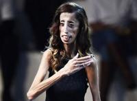 美国零脂肪女孩，丽兹·维拉斯奎兹(体重仅仅只有54斤)