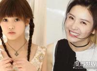 杨子珊整容前后照片对比，很明显卧蚕都整没了