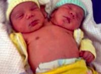 巴西双头婴儿，2012年出生的世界罕见神奇婴儿（身体健康）