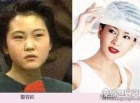 金南珠整容前后对比照片曝光，从路人甲变身气质女王的典范